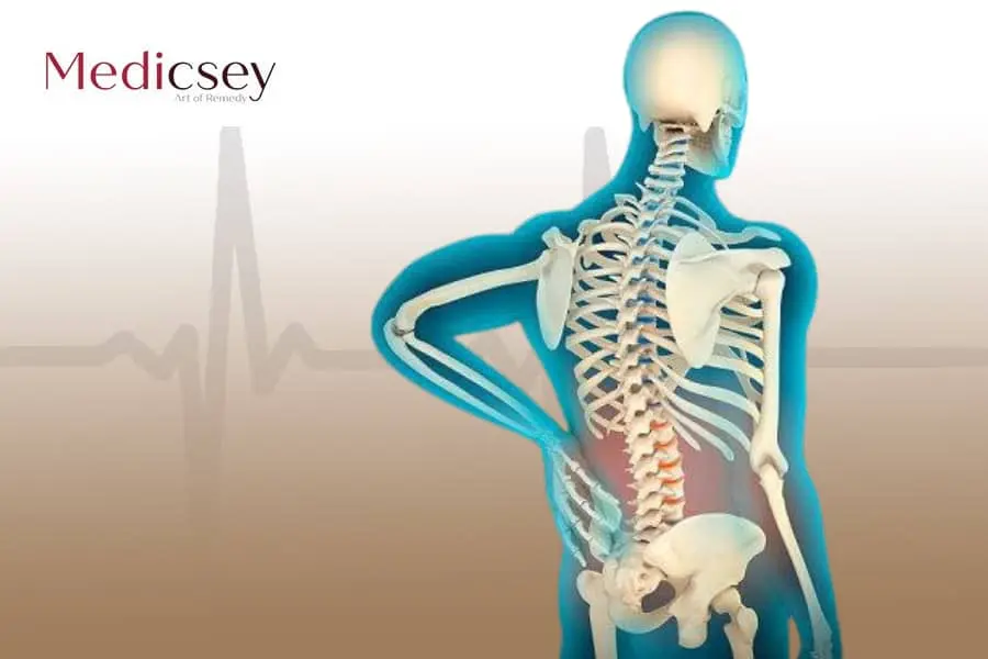 Osteoporosis in Turkey, its causes and treatment