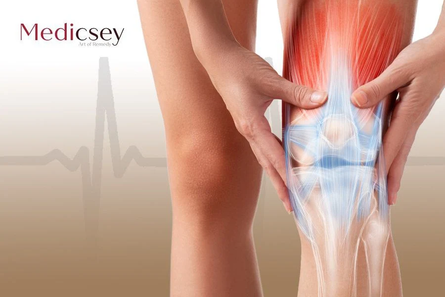 knee replacement surgery in Turkey 