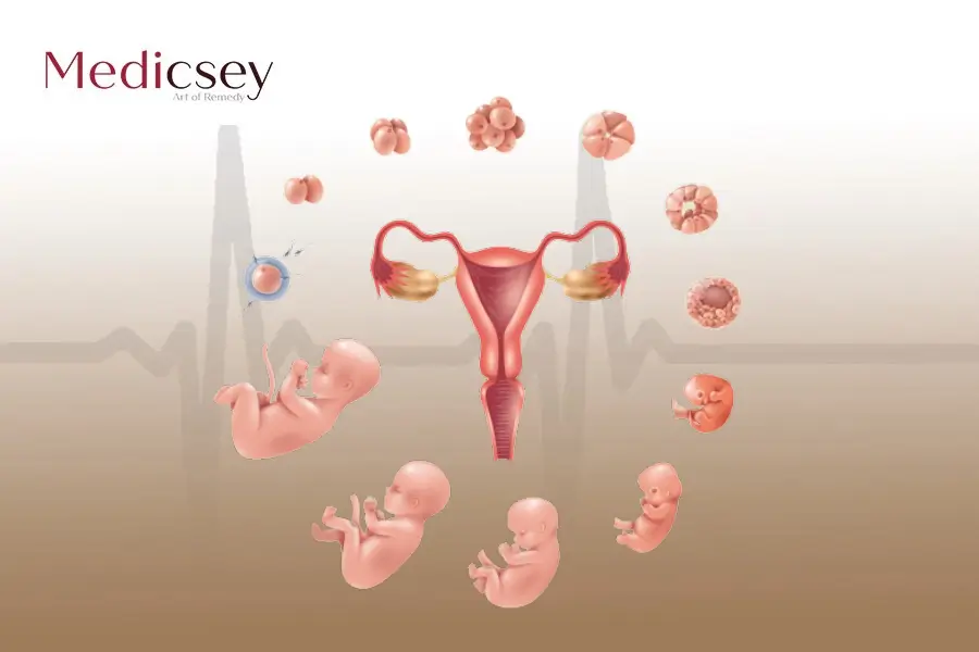 Treatment of ectopic pregnancy in Turkey 