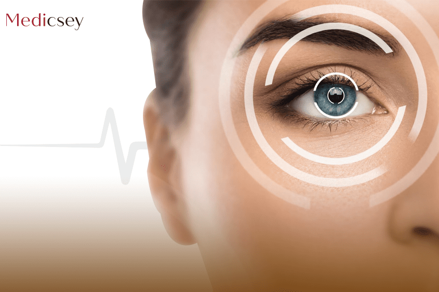 Eyelid laser surgery in Turkey