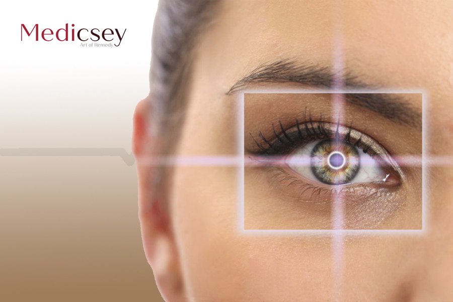 Laser Eye Surgery 