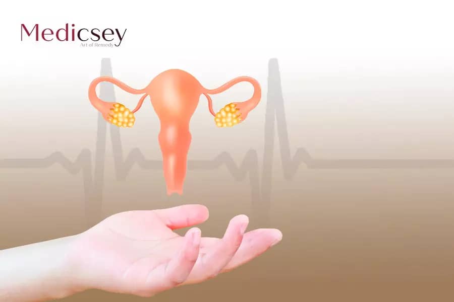 Treatment of endometriosis in Turkey