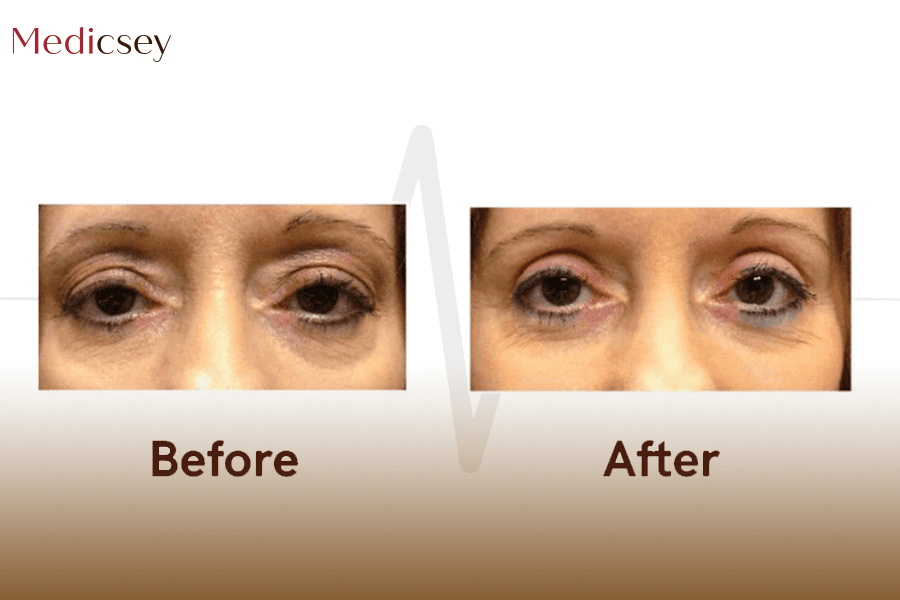 Oculoplastic Surgeon