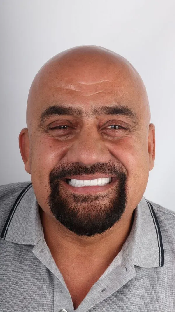 ابتسامة هوليود