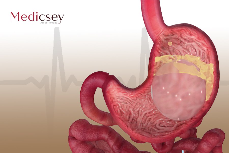 Who is the best doctor for gastric balloon in turkey?