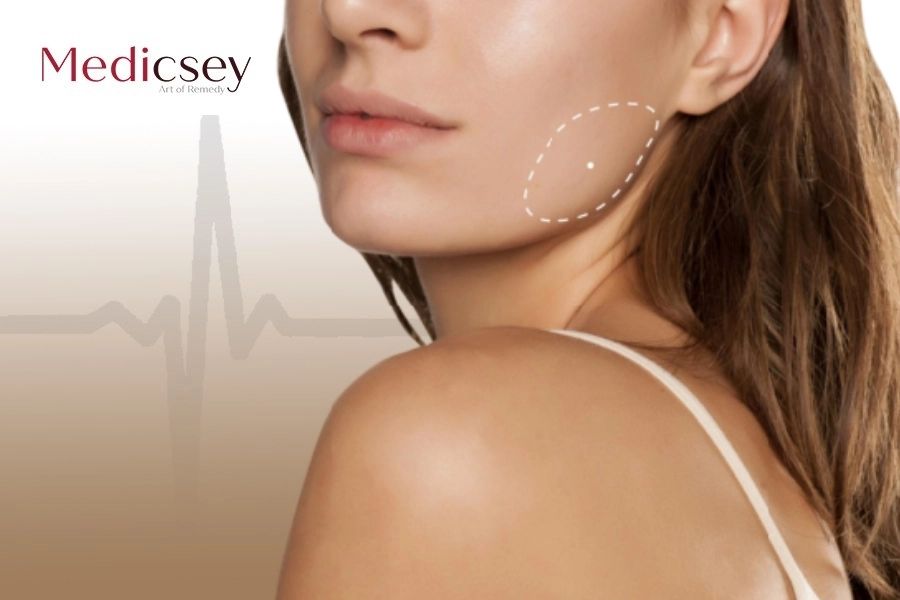 Refine Your Look with Jawline Botox in Turkey
