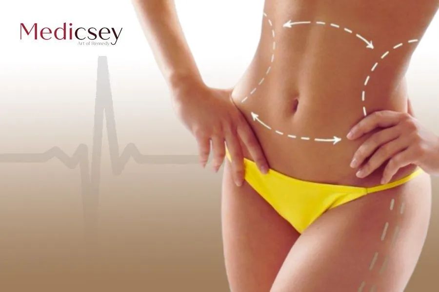 The Types of Liposuction in Turkey: Best Advantages in 2023