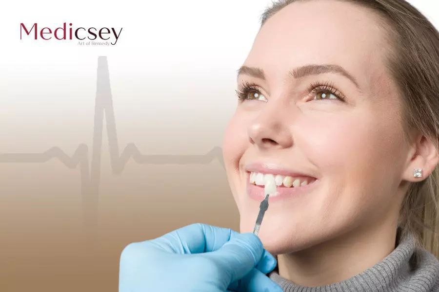 composite veneers turkey price