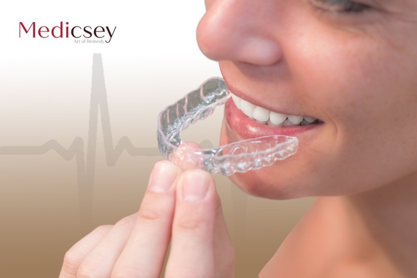 Invisalign in Istanbul is the best affordable guide 2024