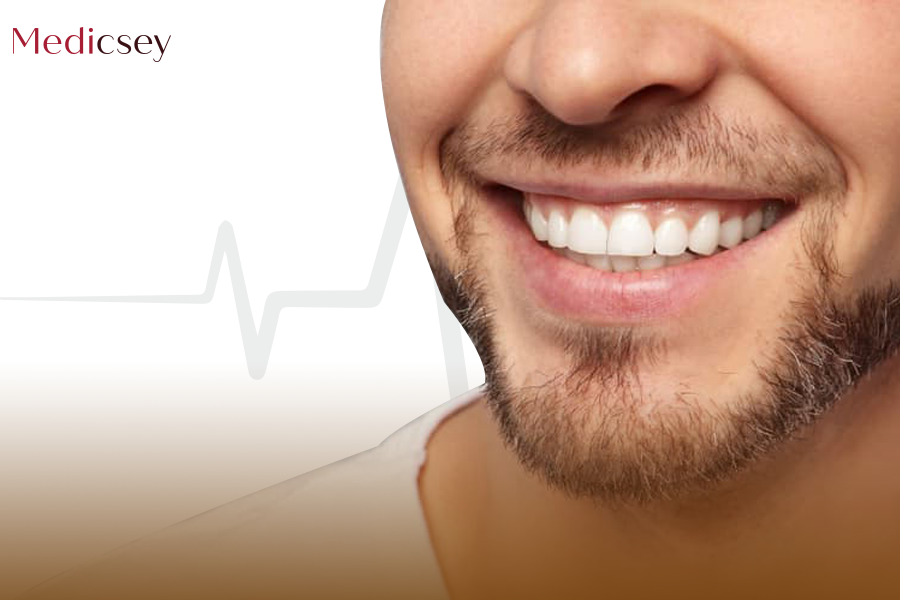 Hollywood Smile