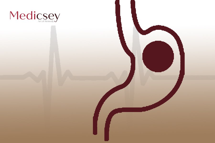 The cheapest gastric balloon in Turkey: the best seller types