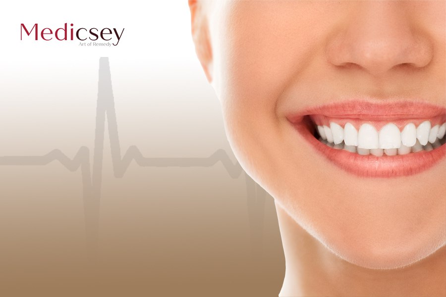 Lumineers Turkey Cost: How is Lumineer Dental Veneer applied