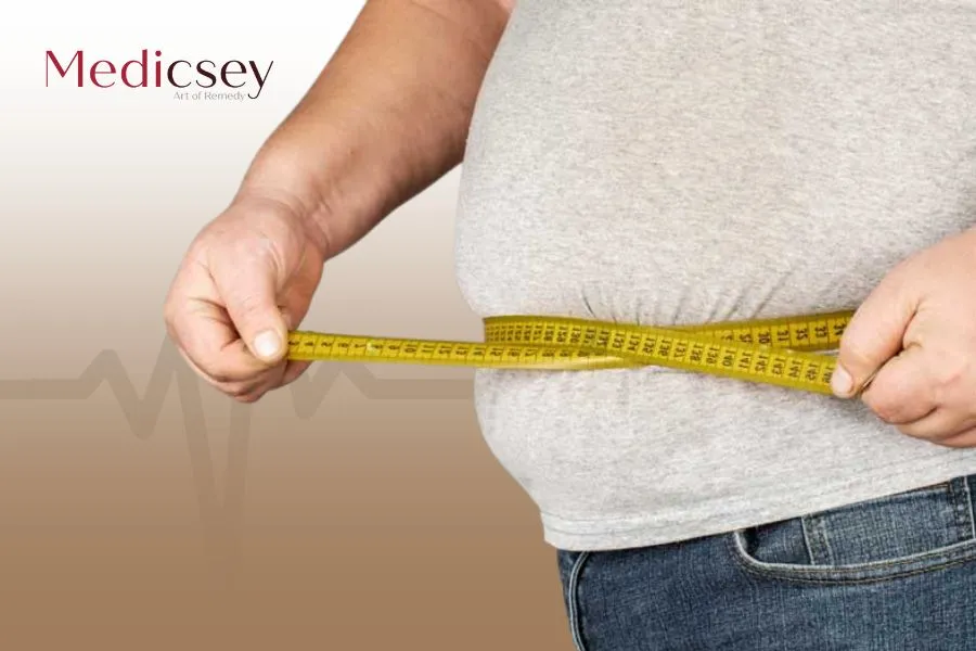 Sleeve gastrique à Istanbul : Tout ce qu’il faut savoir
