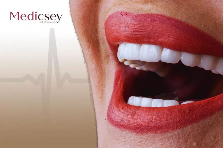  Emax veneers Istanbul