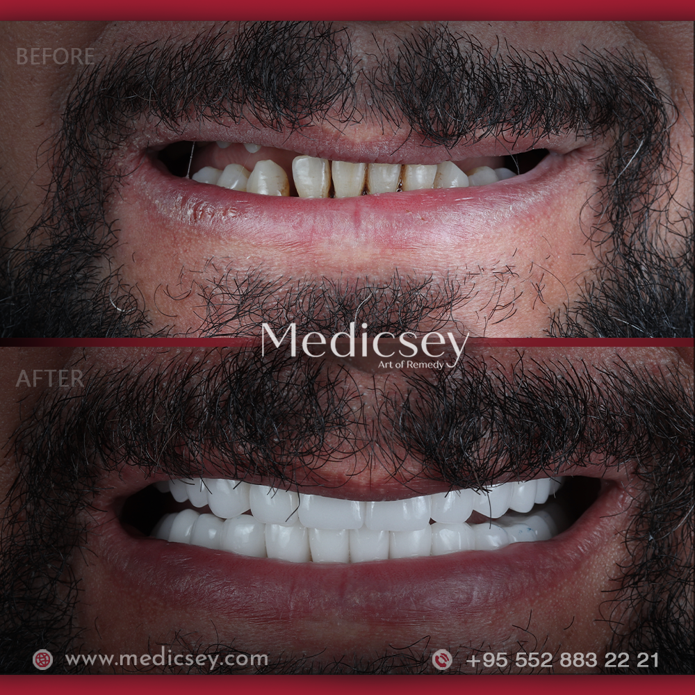 Dental Treatment
