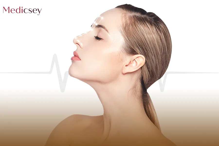 Rhinoplasty