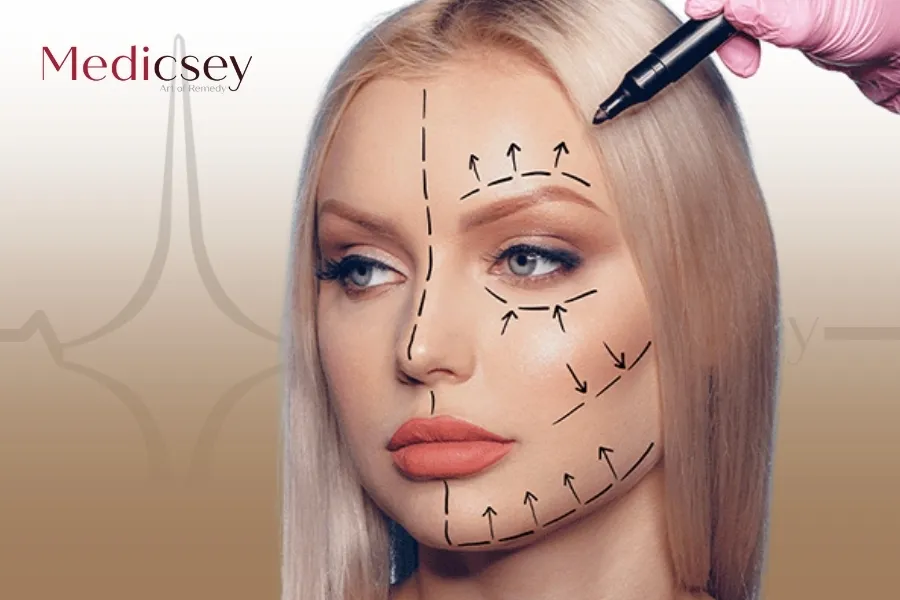 Facelift Surgery in Syria: Everything You Need to Know