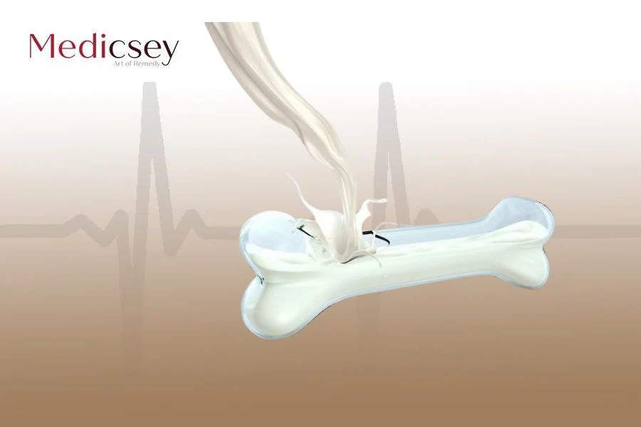 Chirurgie d'allongement